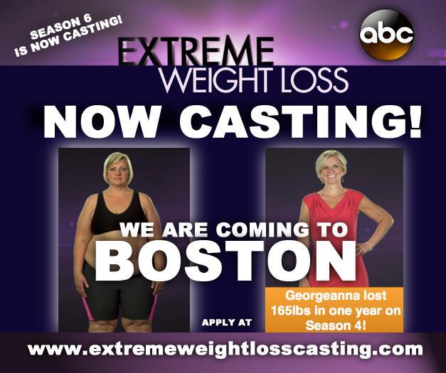 Reality Tv Show Casting In Boston Abc Extreme Weight Loss